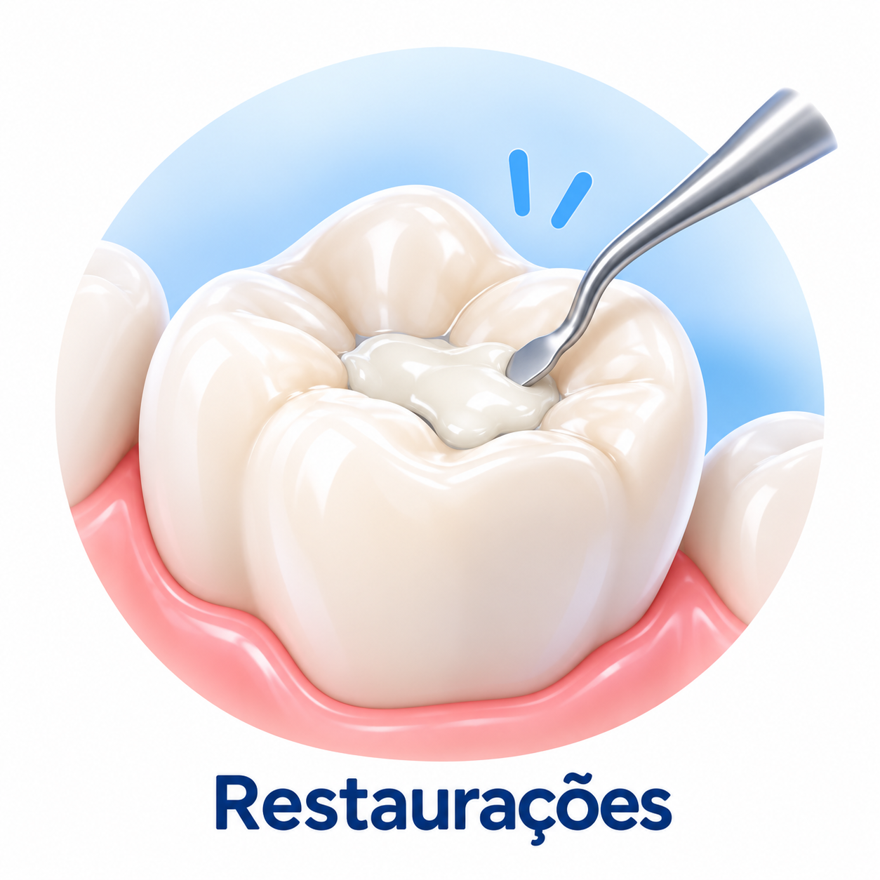 Restaurações